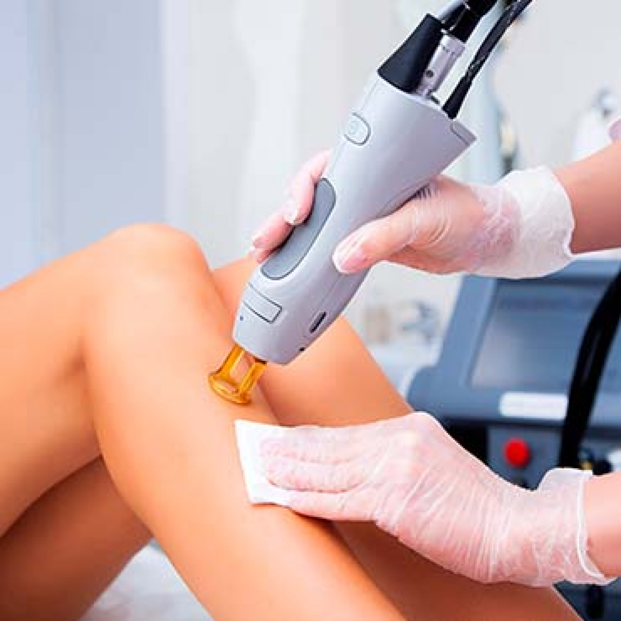 Epilation laser homme et femme pour le corps à Lille